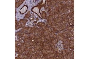 Immunohistochemical staining of human pancreas with ANKRD39 polyclonal antibody  shows strong cytoplasmic positivity in exocrine glandular cells at 1:10-1:20 dilution.