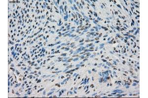 Immunohistochemistry (IHC) image for anti-Budding Uninhibited By Benzimidazoles 1 Homolog beta (Yeast) (BUB1B) antibody (ABIN1496996) (BUB1B antibody)