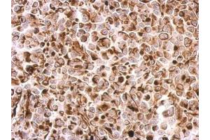 IHC-P Image Desmin antibody detects DES protein at cytosol on H1299 xenograft by immunohistochemical analysis. (Desmin antibody)
