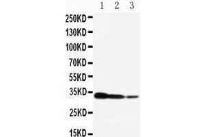 Western Blotting (WB) image for anti-CREB Regulated Transcription Coactivator 2 (CRTC2) (AA 595-611), (C-Term) antibody (ABIN3042964)