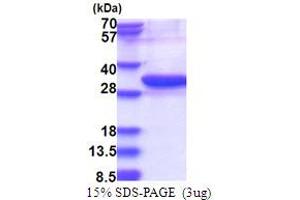 SDS-PAGE (SDS) image for Ubiquitin-Conjugating Enzyme E2Z (UBE2Z) (AA 1-246) protein (His tag) (ABIN5853763)