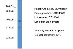 Western Blotting (WB) image for anti-Solute Carrier Family 9 (Sodium/hydrogen Exchanger), Member 3 Regulator 2 (SLC9A3R2) (N-Term) antibody (ABIN785240) (SLC9A3R2 antibody  (N-Term))