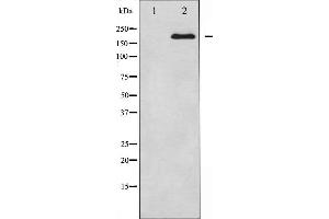 Western blot analysis of BRCA1 expression in whole cell lysates,The lane on the left is treated with the antigen-specific peptide. (BRCA1 antibody  (Internal Region))