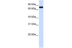 Western Blot showing ZFYVE1 antibody used at a concentration of 1-2 ug/ml to detect its target protein. (ZFYVE1 antibody  (C-Term))