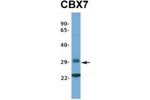 Host:  Rabbit  Target Name:  CBX7  Sample Type:  721_B  Antibody Dilution:  1. (CBX7 antibody  (Middle Region))