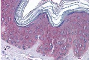 Human Skin: Formalin-Fixed, Paraffin-Embedded (FFPE) (GJB1 antibody  (C-Term))