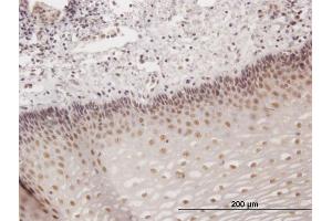 Immunoperoxidase of purified MaxPab antibody to KIAA1443 on formalin-fixed paraffin-embedded human esophagus. (HOMEZ antibody  (AA 1-526))