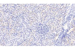 Detection of PDGFC in Human Kidney Tissue using Polyclonal Antibody to Platelet Derived Growth Factor C (PDGFC) (PDGFC antibody  (AA 235-345))