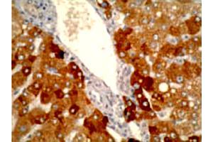 Immunohistochemistry staining using CYP2A6 monoclonal antibody, clone F16 P2 D8  on normal human liver tissue at 1 ug/mL . (CYP2A6 antibody  (C-Term))
