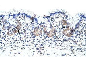 UPF3B antibody was used for immunohistochemistry at a concentration of 4-8 ug/ml to stain EpitheliaI cells of fundic gland (arrows) in Human Stomach. (UPF3B antibody)