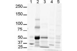 Image no. 1 for anti-GLI Family Zinc Finger 3 (GLI3) (AA 41-57) antibody (ABIN401281) (GLI3 antibody  (AA 41-57))