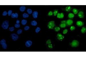 IF analysis of PARP using anti-PARP antibody (ABIN7602277).