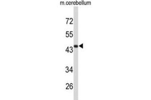 Western Blotting (WB) image for anti-Fibromodulin (FMOD) antibody (ABIN3004097)