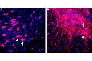 Expression of LINGO-1 in rat brain and spinal cord - Immunohistochemical staining of perfusion-fixed frozen rat brain sections using Anti-LINGO-1 (extracellular) Antibody (ABIN7043298, ABIN7044790 and ABIN7044791), (1:400), followed by donkey-anti-rabbit-Cy3. (LINGO1 antibody  (Extracellular, N-Term))