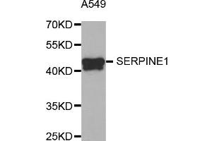 Western blot analysis of extracts of A-549 cells, using SERPINE1 antibody (ABIN5973656) at 1/1000 dilution. (PAI1 antibody)
