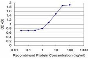 Detection limit for recombinant GST tagged STMN2 is approximately 1ng/ml as a capture antibody. (STMN2 antibody  (AA 1-90))