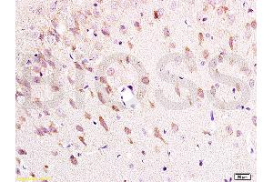 Formalin-fixed and paraffin embedded: rat brain tissue labeled with Anti-NK-2R Polyclonal Antibody (ABIN725315), Unconjugated at 1:200 followed by conjugation to the secondary antibody and DAB staining