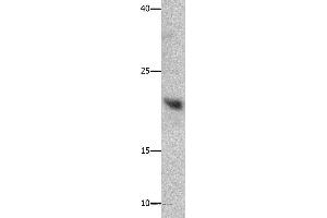 Western blot analysis of Mouse liver tissue, using GFER Polyclonal Antibody at dilution of 1:750