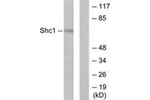 Western blot analysis of extracts from HeLa cells, treated with Calyculin A 50nM 15', using Shc (Ab-427) Antibody.