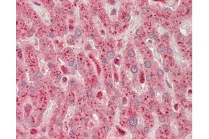 Human Liver: Formalin-Fixed, Paraffin-Embedded (FFPE). (PHKG1 antibody  (AA 68-117))