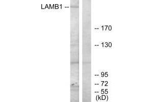 Western blot analysis of extracts from HepG2 cells, using LAMB1 antibody.