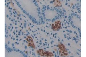 Immunohistochemistry (IHC) image for anti-Apoptosis-Inducing Factor, Mitochondrion-Associated, 1 (AIFM1) (AA 103-322) antibody (ABIN7433090)