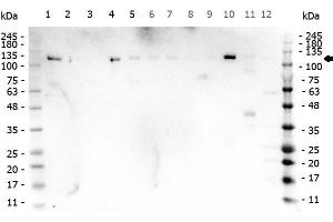 Western Blotting (WB) image for anti-Poly (ADP-Ribose) Polymerase 1 (PARP1) (N-Term) antibody (ABIN5706805)