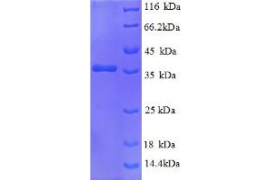 SDS-PAGE (SDS) image for Heat Shock Factor Binding Protein 1 (HSBP1) (AA 1-75), (partial) protein (GST tag) (ABIN5712057) (HSBP1 Protein (AA 1-75, partial) (GST tag))