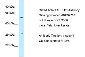 Western Blotting (WB) image for anti-Cysteine-Rich Secretory Protein LCCL Domain Containing 1 (CRISPLD1) (Middle Region) antibody (ABIN2789246) (CRISPLD1 antibody  (Middle Region))