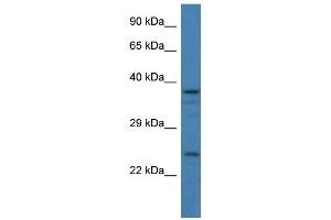 Western Blot showing GAP43 antibody used at a concentration of 1 ug/ml against 293T Cell Lysate (GAP43 antibody  (C-Term))
