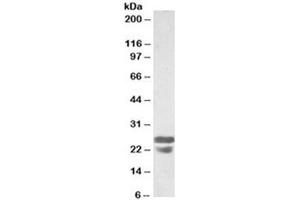 Western blot testing of mouse spleen lysates with ASC antibody at 0. (PYCARD antibody)