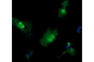 Image no. 5 for anti-Mitogen-Activated Protein Kinase Kinase 3 (MAP2K3) antibody (ABIN1499401)