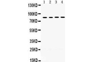 Western Blotting (WB) image for anti-P450 (Cytochrome) Oxidoreductase (POR) (AA 633-668), (C-Term) antibody (ABIN3043443) (POR antibody  (C-Term))