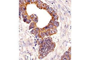 Immunohistochemistry (Paraffin-embedded Sections) (IHC (p)) image for anti-Proprotein Convertase Subtilisin/kexin Type 9 (PCSK9) (AA 153-183), (N-Term) antibody (ABIN652320)