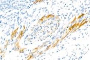 Immunohistochemistry analysis of paraffin-embedded rat embryo using CNTN5 (ABIN7073575) at dilution of 1: 2000 (Contactin 5 antibody)