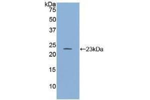 Western blot analysis of recombinant Human RGS4. (RGS4 antibody  (AA 38-205))