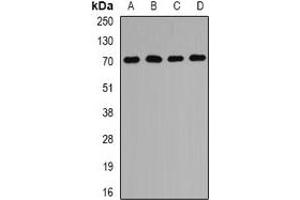 Western blot analysis of PEX5 expression in MCF7 (A), Hela (B), mouse liver (C), mouse kidney (D) whole cell lysates. (PEX5 antibody)