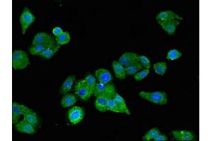 Immunofluorescent analysis of HepG2 cells using ABIN7158800 at dilution of 1:100 and Alexa Fluor 488-congugated AffiniPure Goat Anti-Rabbit IgG(H+L) (SCARB2 antibody  (AA 47-128))