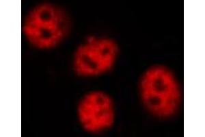 ABIN6267622 staining A431 by IF/ICC. (PTPN11 antibody  (pTyr580))