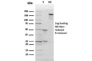 SDS-PAGE Analysis of Purified p27 Mouse Monoclonal Antibody (SX53G8). (CDKN1B antibody)