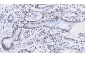 Immunohistochemistry (IHC) image for anti-Kruppel-Like Factor 4 (Gut) (KLF4) (AA 1-170), (N-Term) antibody (ABIN336104) (KLF4 antibody  (N-Term))