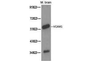 Western Blotting (WB) image for anti-Vascular Cell Adhesion Molecule 1 (VCAM1) antibody (ABIN1875313) (VCAM1 antibody)