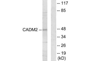 Western Blotting (WB) image for anti-Cell Adhesion Molecule 2 (CADM2) (Internal Region) antibody (ABIN1850234) (CADM2 antibody  (Internal Region))
