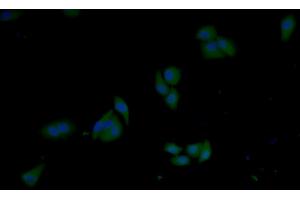 Detection of GSTp in Human MCF7 cell using Polyclonal Antibody to Glutathione S Transferase Pi (GSTp) (GSTP1 antibody  (AA 1-210))