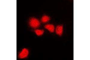 Immunofluorescent analysis of CDK1/2/3 (pT14) staining in HeLa cells. (CDK1/2/3 (N-Term), (pSer14) antibody)