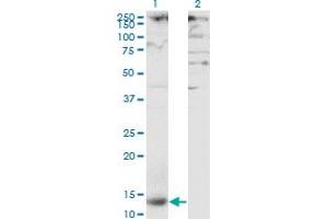 Western Blot analysis of CLEC4M expression in transfected 293T cell line by CLEC4M monoclonal antibody (M01), clone 2G1. (C-Type Lectin Domain Family 4, Member M (CLEC4M) (AA 285-394) antibody)