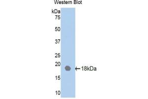 Western blot analysis of the recombinant protein. (IL18RAP antibody  (AA 117-240))