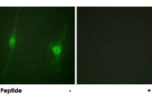 Immunofluorescence analysis of NIH/3T3 cells, using STK11 polyclonal antibody . (LKB1 antibody)