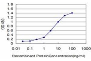 Detection limit for recombinant GST tagged KIAA2002 is approximately 0. (PEAK1 antibody  (AA 1151-1250))