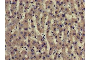 Immunohistochemistry of paraffin-embedded human liver tissue using ABIN7173904 at dilution of 1:100 (TRADD antibody  (AA 1-312))